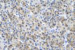 P62/SQSTM1 Antibody in Immunohistochemistry (Paraffin) (IHC (P))