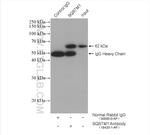 P62/SQSTM1 Antibody in Immunoprecipitation (IP)