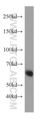 P62/SQSTM1 Antibody in Western Blot (WB)