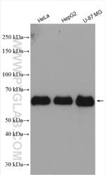 P62/SQSTM1 Antibody in Western Blot (WB)