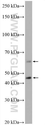 P62/SQSTM1 Antibody in Western Blot (WB)