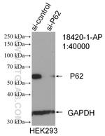 P62/SQSTM1 Antibody in Western Blot (WB)
