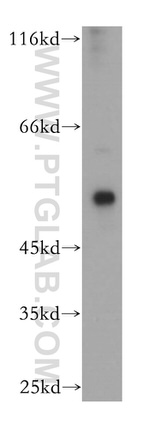 Calsequestrin 2 Antibody in Western Blot (WB)