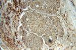 PSAP Antibody in Immunohistochemistry (Paraffin) (IHC (P))