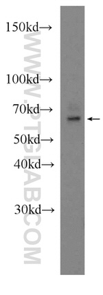 PSAP Antibody in Western Blot (WB)