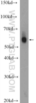 PSAP Antibody in Western Blot (WB)