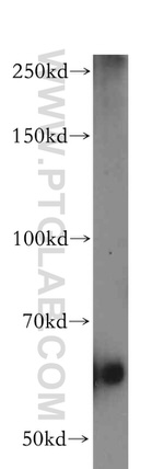 PSAP Antibody in Western Blot (WB)