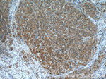 PRMT5 Antibody in Immunohistochemistry (Paraffin) (IHC (P))