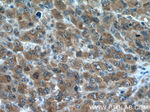 PRMT5 Antibody in Immunohistochemistry (Paraffin) (IHC (P))