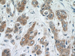 PRMT5 Antibody in Immunohistochemistry (Paraffin) (IHC (P))