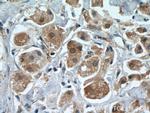 PRMT5 Antibody in Immunohistochemistry (Paraffin) (IHC (P))