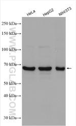 PRMT5 Antibody in Western Blot (WB)