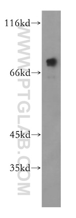 PRMT5 Antibody in Western Blot (WB)