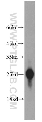 UQCRFS1 Antibody in Western Blot (WB)