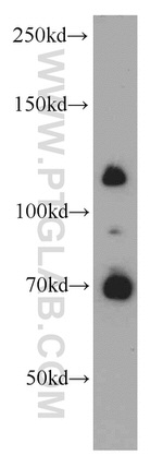 USP37 Antibody in Western Blot (WB)