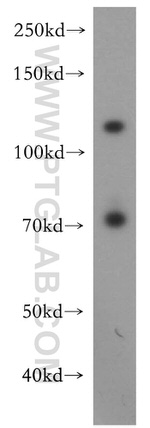 USP37 Antibody in Western Blot (WB)