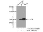 PPIF Antibody in Immunoprecipitation (IP)