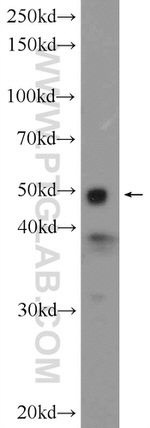 IKBKG Antibody in Western Blot (WB)