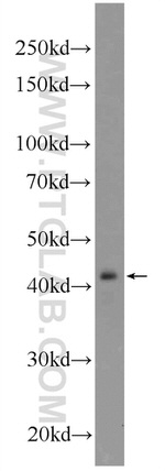 IKBKG Antibody in Western Blot (WB)