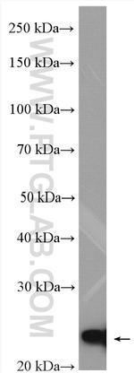 PPP1R14B Antibody in Western Blot (WB)