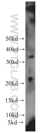 PPP1R14B Antibody in Western Blot (WB)