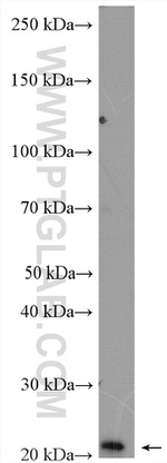 PPP1R14B Antibody in Western Blot (WB)