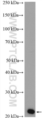 PPP1R14B Antibody in Western Blot (WB)