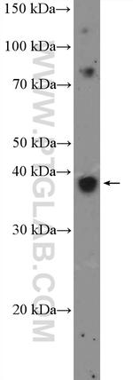 XRCC3 Antibody in Western Blot (WB)