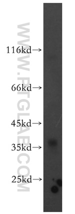 CACNG5 Antibody in Western Blot (WB)