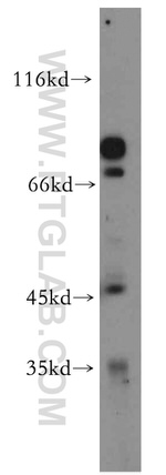 CACNG5 Antibody in Western Blot (WB)