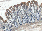 IGFBP4 Antibody in Immunohistochemistry (Paraffin) (IHC (P))