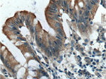 IGFBP4 Antibody in Immunohistochemistry (Paraffin) (IHC (P))