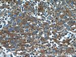 CYP1B1 Antibody in Immunohistochemistry (Paraffin) (IHC (P))