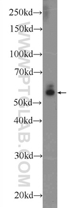 CYP1B1 Antibody in Western Blot (WB)