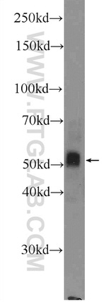 CYP1B1 Antibody in Western Blot (WB)