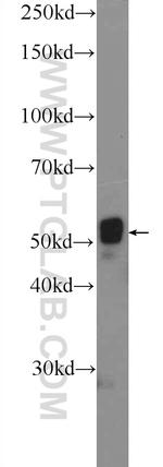 CYP1B1 Antibody in Western Blot (WB)