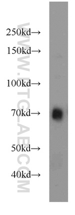 PLAP Antibody in Western Blot (WB)