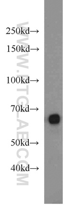 PLAP Antibody in Western Blot (WB)