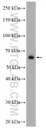 PLAP Antibody in Western Blot (WB)