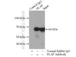 PLAP Antibody in Immunoprecipitation (IP)