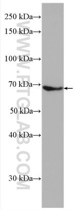 PLAP Antibody in Western Blot (WB)