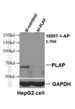 PLAP Antibody in Western Blot (WB)