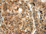 PRUNE Antibody in Immunohistochemistry (Paraffin) (IHC (P))