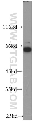 PRUNE Antibody in Western Blot (WB)