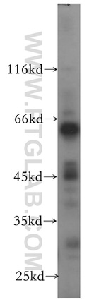 PRUNE Antibody in Western Blot (WB)