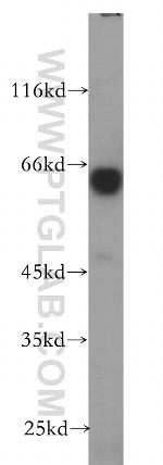 PRUNE Antibody in Western Blot (WB)