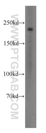 SMMHC Antibody in Western Blot (WB)