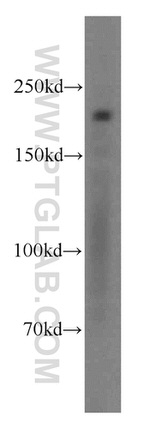 SMMHC Antibody in Western Blot (WB)