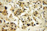 iASPP Antibody in Immunohistochemistry (Paraffin) (IHC (P))