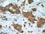 iASPP Antibody in Immunohistochemistry (Paraffin) (IHC (P))